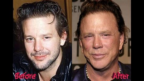 mickey rorke|mickey rourke before after.